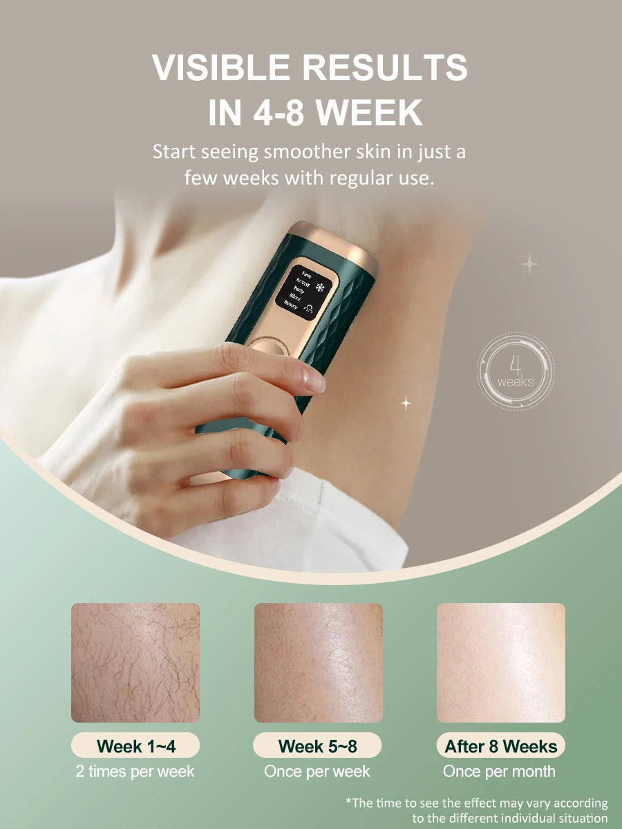 Depiladora láser IPL con enfriamiento